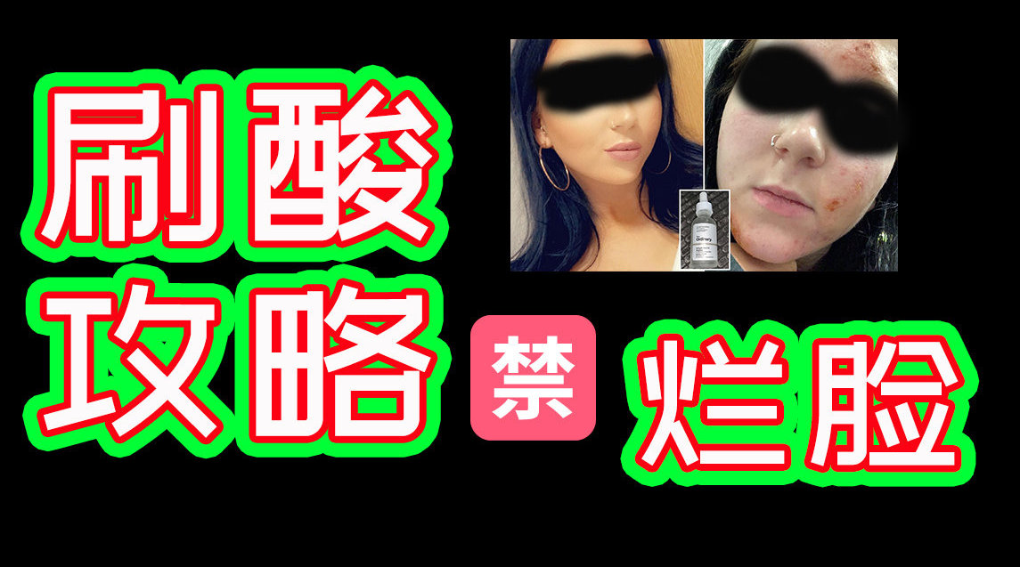 保姆级刷酸攻略
